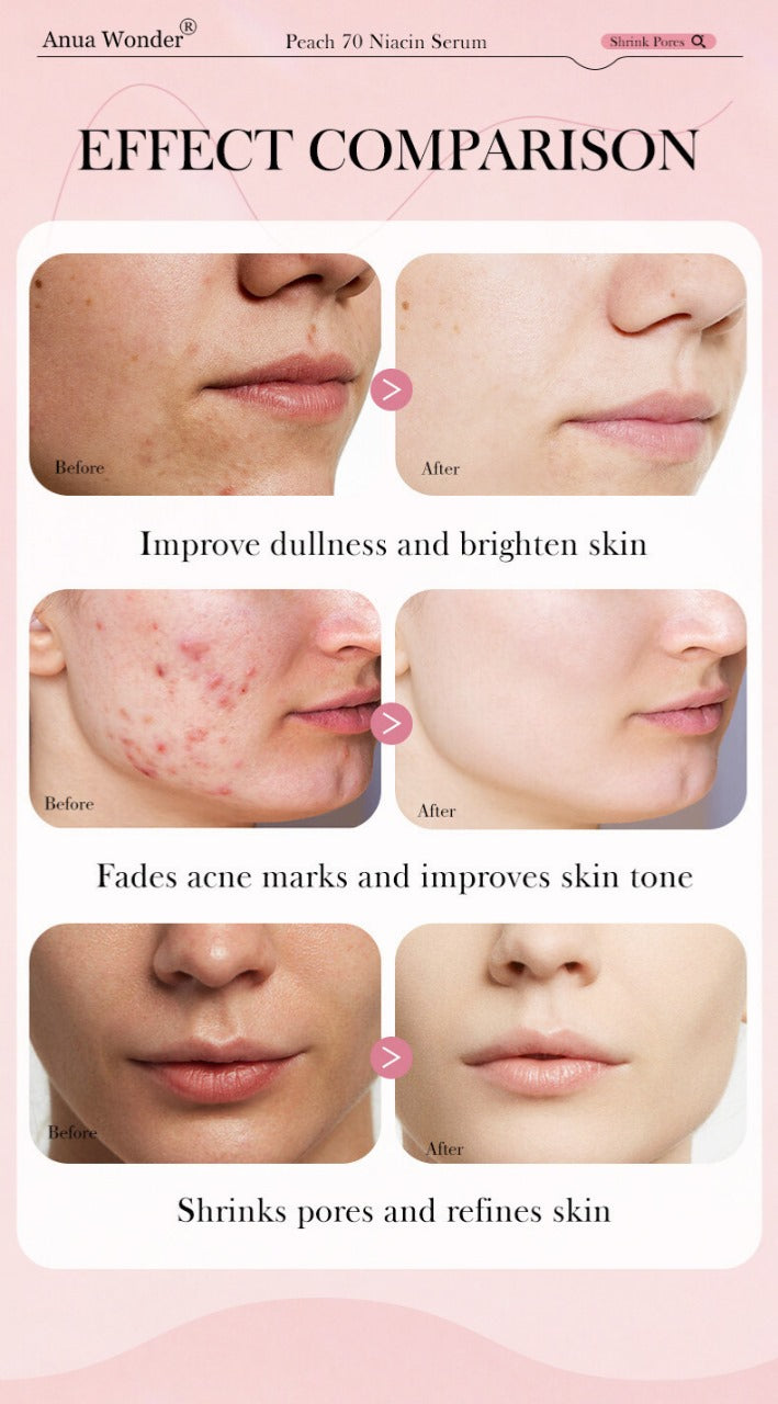 Anua Wonder Peach 70% Niacinamide Serum
